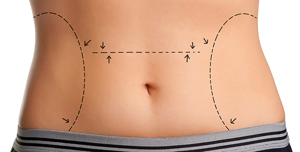 cirurgia-plastica-e-o-cigarro